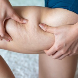 2 x Intensywny serum antycellulitowy SLIMBELL